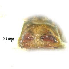 Neriene macella (Thorell, 1898) © James Koh  • Epigyne • Ventral • ♀ • Adult
