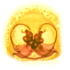 Hyllus diardi (Walckenaer, 1837) © Joseph K H Koh  • Epigyne • Dorsal • Cleared • Dissected • ♀ • Adult
