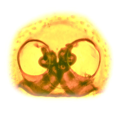 Hyllus diardi (Walckenaer, 1837) © Joseph K H Koh  • Epigyne • Ventral • Cleared • Dissected • ♀ • Adult