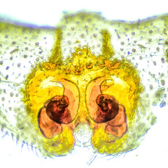 Heteropoda bufocorniculans Jäger & Koh, 2024 © Joseph K H Koh  • Epigyne • Dorsal • Cleared • ♀ • Adult
